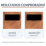 contorno-de-ojos-anti.