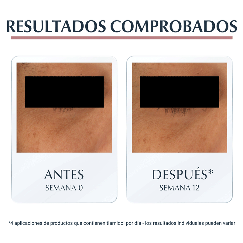 contorno-de-ojos-anti.