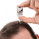 aminexil-clinical-hombre-3337875525930.