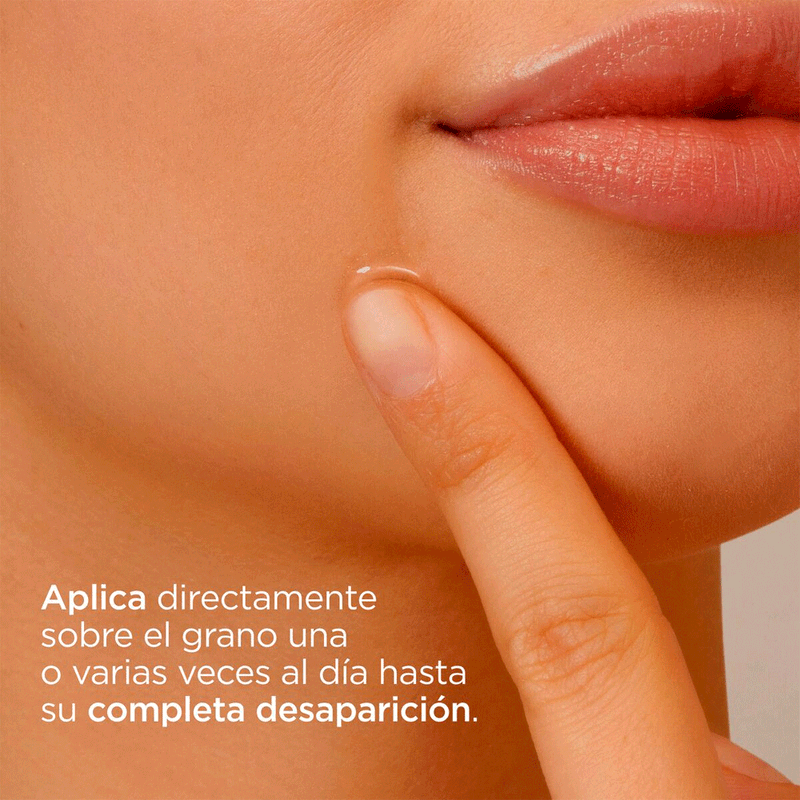 ACNIBEN-ON-THE-SPOT-8470001855107.
