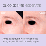 gel-glicoisdin-moderate-15-8470002426382.