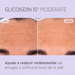 GLICOISDIN-10-SOFT-8429420175303.