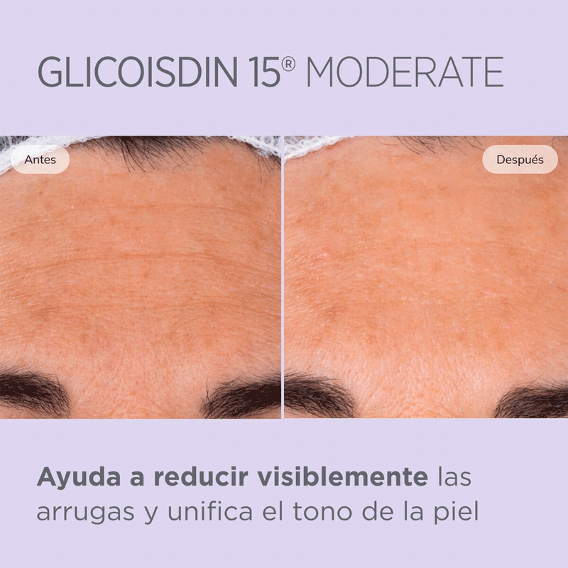 GLICOISDIN-10-SOFT-8429420175303.
