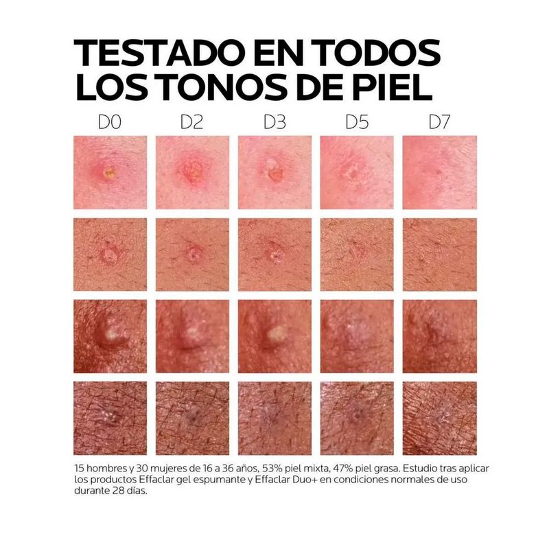 effaclar-duo-m.