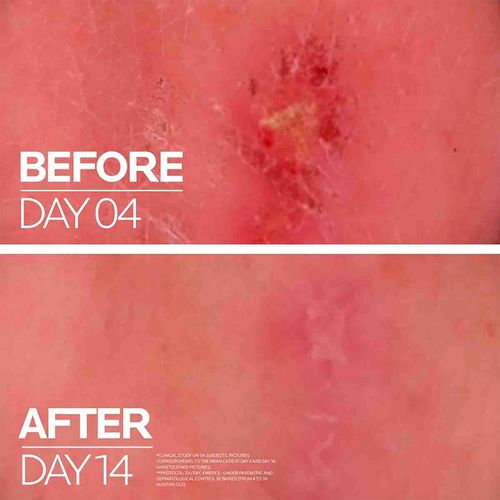 Cicaplast Baume B5 Bálsamo Calmante Reparador La Roche-Posay x 40ml