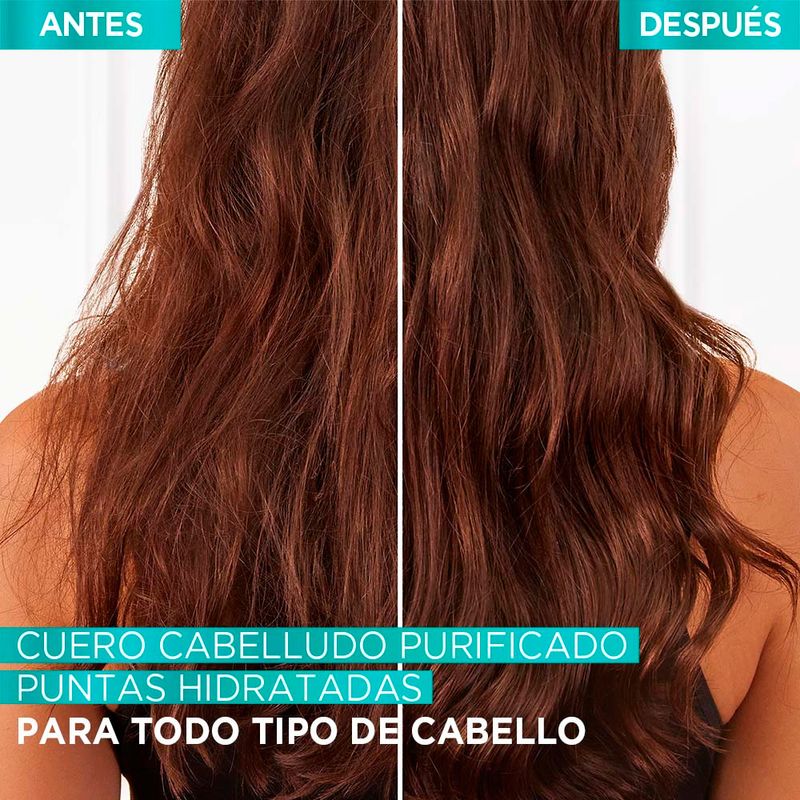 elvive-ac-hidra-equilibrante-7509552876420.8jpg.jpg