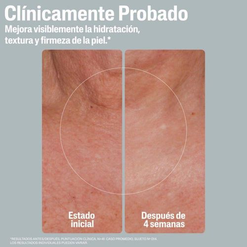 Crema Hidratante Reafirmante Cetaphil Skin Activator 350g